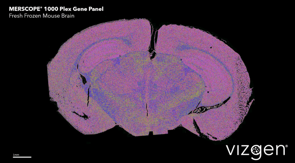 1000 Plex Mouse Brain Transcripts Branded Data Image