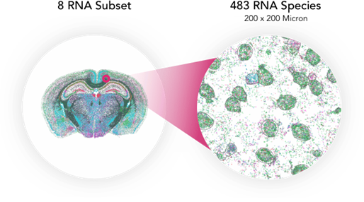 Figure 3 Brain Data LP