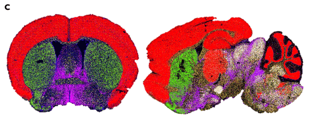 coronal and sagittal slices small