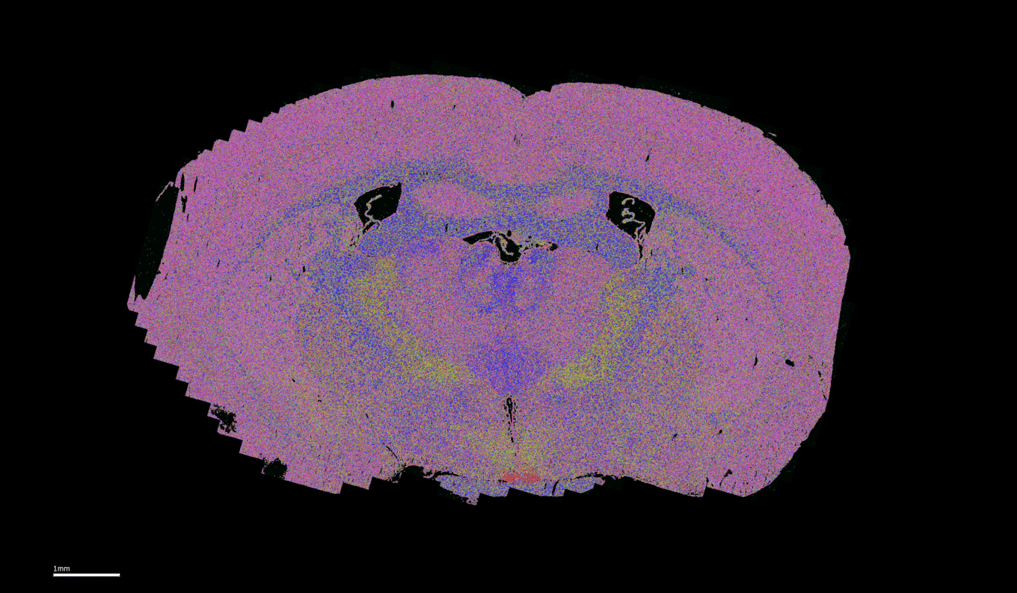 mouse brain 1k